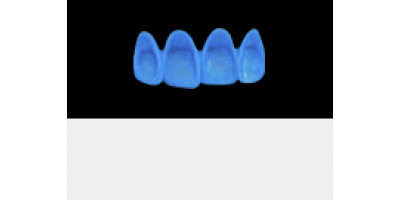 Cod.A20Lingual : 15x  wax lingual bridges,  MEDIUM, Tapering ovoid, TOOTH 12-22, compatible with Cod.C20Facing,TOOTH 12-22 for long-term provisionals preparation