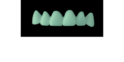 Cod.C3Facing : 10x  wax facings-bridges,  MEDIUM, Square tapering, TOOTH 13-23, compatible with Cod.A3Lingual,TOOTH 13-23 for long-term provisionals preparation