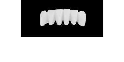 Cod.S16LOWER ANTERIOR : 10x  solid (not hollow) wax bridges, MEDIUM, Overlapping, (43-33), compatible to Cod.E16LOWER ANTERIOR (hollow), (43-33)