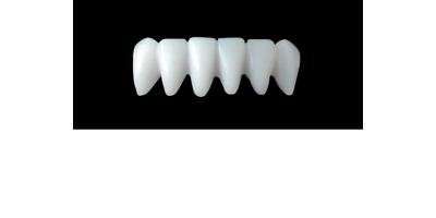Cod.E12LOWER ANTERIOR: 10x  wax facings-bridges (hollow), SMALL, Aligned, (43-33), compatible with solid (not  hollow) wax bridges Cod.S12LOWER ANTERIOR, (43-33)