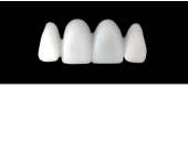 Cod.S17UPPER ANTERIOR : 15x  solid (not hollow) wax bridges, X-LARGE, Square tapering ovoid, (12-22), compatible to Cod.E17UPPER ANTERIOR (hollow), (12-22)