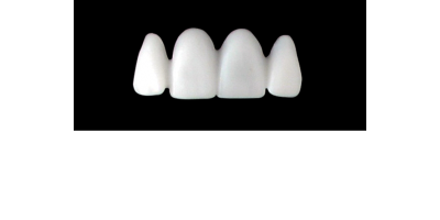 Cod.S17UPPER ANTERIOR : 15x  solid (not hollow) wax bridges, X-LARGE, Square tapering ovoid, (12-22), compatible to Cod.E17UPPER ANTERIOR (hollow), (12-22)
