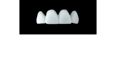 Cod.S19UPPER ANTERIOR : 15x  solid (not hollow) wax bridges, MEDIUM, Square tapering, arch, (12-22), compatible to Cod.E19UPPER ANTERIOR (hollow), (12-22)