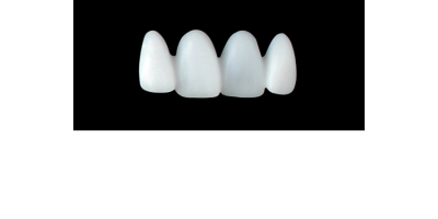 Cod.S20UPPER ANTERIOR : 15x  solid (not hollow) wax bridges, MEDIUM, Tapering ovoid, overlapping, (12-22), compatible to Cod.E20UPPER ANTERIOR (hollow), (12-22)