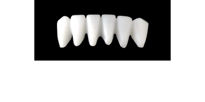 Cod.S9LOWER ANTERIOR : 10x  solid (not hollow) wax bridges, LARGE, Aligned, (43-33), compatible to Cod.E9LOWER ANTERIOR (hollow), (43-33)